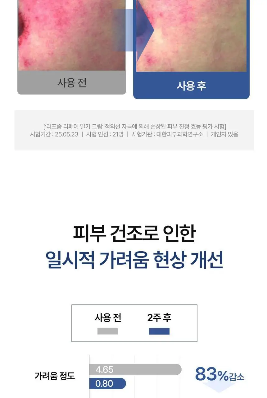 [단독기획/화잘먹 대란템] 샤이샤이샤이 리포좀 리페어 밀키 크림 50ml 기획 (+15ml) 상세페이지 28